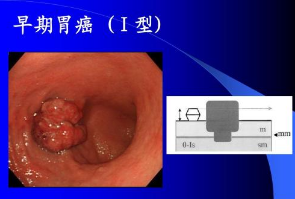 水污染與癌癥高發(fā)區(qū)必備這款儀器